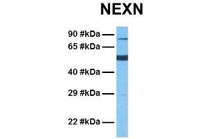 Host:  Rabbit  Target Name:  NEXN  Sample Tissue:  Human Fetal Lung  Antibody Dilution:  1. (NEXN 抗体  (Middle Region))