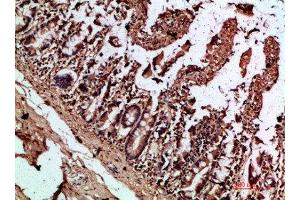 Immunohistochemical analysis of paraffin-embedded human-colon, antibody was diluted at 1:200 (IL17C 抗体  (AA 81-130))