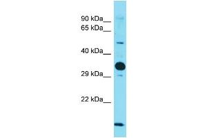 Host: Rabbit  Target Name: Nus1  Sample Tissue: Mouse Heart lysates  Antibody Dilution: 1. (Nogo B Receptor 抗体  (Middle Region))