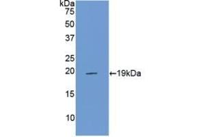 Detection of Recombinant PROCR, Rat using Polyclonal Antibody to Endothelial protein C receptor (EPCR) (PROCR 抗体  (AA 59-217))