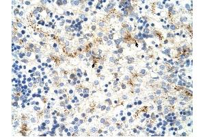 MOV10 antibody was used for immunohistochemistry at a concentration of 4-8 ug/ml to stain Hepatocytes (arrows) in Human Liver. (MOV10 抗体)