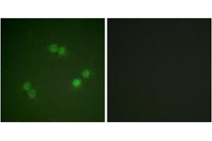 Immunofluorescence analysis of A549 cells, using SF1 (Phospho-Ser82) antibody. (Splicing Factor 1 抗体  (pSer82))