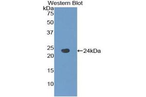 Detection of Recombinant TACR2, Human using Polyclonal Antibody to Tachykinin Receptor 2 (TACR2) (TACR2 抗体  (AA 92-290))