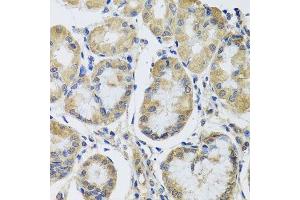 Immunohistochemistry of paraffin-embedded human stomach using MRPL1 antibody. (MRPL1 抗体  (AA 51-325))
