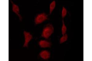 Immunofluorescence (fixed cells) (IF/ICC) image for anti-Cyclin-Dependent Kinase 1 (CDK1) (pThr14) antibody (ABIN6256473)