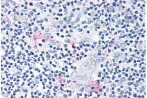 Anti-ROR Gamma antibody  ABIN1049298 IHC staining of human thymus. (RORC 抗体  (Modulating Domain))