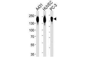 Western blot analysis of lysate from A431, HUVEC, PC3 cell line (left to right) using anti-EGFR antibody diluted at 1:1000 for each lane. (EGFR 抗体  (AA 1004-1033))