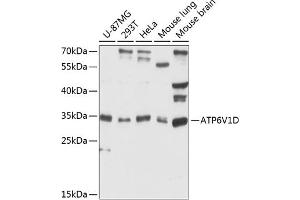 Western Blotting (WB) image for anti-ATPase, H+ Transporting, Lysosomal 34kDa, V1 Subunit D (ATP6V1D) (AA 1-247) antibody (ABIN6137348)