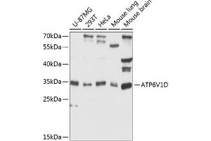 Western blot analysis of extracts of various cell lines, using V1D antibody (ABIN6127397, ABIN6137348, ABIN6137349 and ABIN6216761) at 1:3000 dilution. (ATP6V1D 抗体  (AA 1-247))