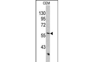 Western blot analysis of KRT10 antibody (Center) (ABIN390659 and ABIN2840954) in CEM cell line lysates (35 μg/lane). (Keratin 10 抗体  (AA 318-346))