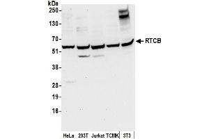 anti-tRNA-Splicing Ligase RtcB Homolog (RTCB) (AA 200-250) antibody