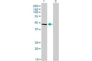 Western Blot analysis of CREB3 expression in transfected 293T cell line by CREB3 monoclonal antibody (M01), clone 3H5. (CREB3 抗体  (AA 273-371))