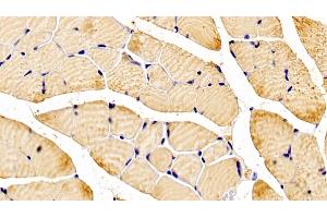 Detection of NT5C in Mouse Skeletal muscle Tissue using Polyclonal Antibody to 5',3'-Nucleotidase, Cytosolic (NT5C) (NT5C 抗体  (AA 12-200))