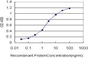 Detection limit for recombinant GST tagged STAG1 is approximately 0. (Stromal Antigen 1 抗体  (AA 1112-1221))