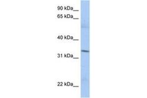Image no. 1 for anti-Mitochondrial Ribosomal Protein L15 (MRPL15) (AA 35-84) antibody (ABIN6743415) (MRPL15 抗体  (AA 35-84))
