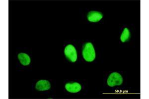 Immunofluorescence of monoclonal antibody to ZNF207 on HeLa cell. (ZNF207 抗体  (AA 1-110))