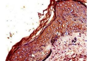 Immunohistochemistry of paraffin-embedded human skin tissue using ABIN7146648 at dilution of 1:100 (CNR2 抗体  (AA 305-360))