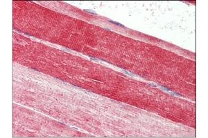 Skeletal muscle, Human: Formalin-Fixed, Paraffin-Embedded (FFPE) (FABP7 抗体  (C-Term))