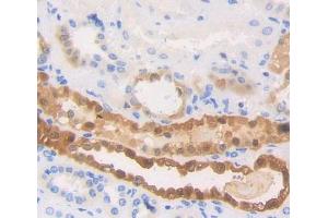 Used in DAB staining on fromalin fixed paraffin- embedded Kidney tissue (HSPA6 抗体  (AA 1-387))