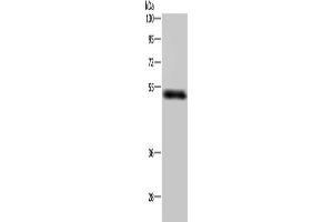 Gel: 8 % SDS-PAGE, Lysate: 40 μg, Lane: Human placenta tissue, Primary antibody: ABIN7192677(STK26 Antibody) at dilution 1/400, Secondary antibody: Goat anti rabbit IgG at 1/8000 dilution, Exposure time: 5 minutes (STK26/MST4 抗体)