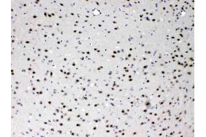 PSMA3 was detected in paraffin-embedded sections of mouse brain tissues using rabbit anti- PSMA3 Antigen Affinity purified polyclonal antibody (Catalog # ) at 1 µg/mL. (PSMA3 抗体  (Middle Region))