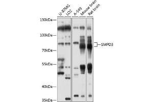 Western blot analysis of extracts of various cell lines, using SMPD3 antibody (ABIN6128775, ABIN6148146, ABIN6148147 and ABIN6214354) at 1:1000 dilution. (SMPD3 抗体  (AA 416-655))