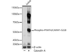 Western blot analysis of extracts of Jurkat cells, using Phospho-PRMT4/C-S228 antibody (ABIN3020120, ABIN3020121, ABIN3020122 and ABIN1681432) at 1:1000 dilution. (CARM1 抗体  (pSer228))