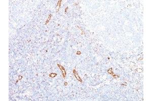 Formalin-fixed, paraffin-embedded human tonsil stained with VEGF antibody (VEGF/1063). (VEGFA 抗体)