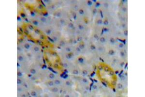Used in DAB staining on fromalin fixed paraffin-embedded Kidney tissue