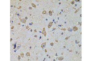 Immunohistochemistry of paraffin-embedded Mouse brain using EIF4A2 Polyclonal Antibody at dilution of 1:100 (40x lens). (EIF4A2 抗体)