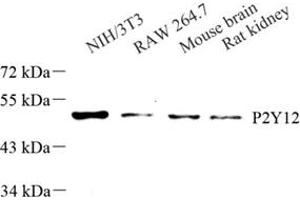 P2RY12 抗体