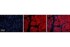 Rabbit Anti-Tnks Antibody  Catalog Number: ARP33978_P050 Formalin Fixed Paraffin Embedded Tissue: Human Adult heart  Observed Staining: Cytoplasmic Primary Antibody Concentration: 1:600 Secondary Antibody: Donkey anti-Rabbit-Cy2/3 Secondary Antibody Concentration: 1:200 Magnification: 20X Exposure Time: 0. (TNKS 抗体  (Middle Region))