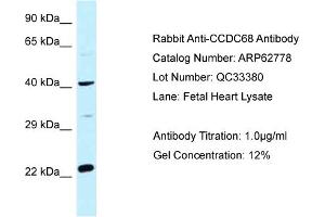 Western Blotting (WB) image for anti-Coiled-Coil Domain Containing 68 (CCDC68) (Middle Region) antibody (ABIN2774351) (CCDC68 抗体  (Middle Region))