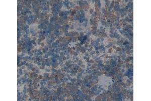 Used in DAB staining on fromalin fixed paraffin- embedded Kidney tissue (AANAT 抗体  (AA 22-235))