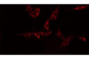 ABIN6274596 staining HepG2 by IF/ICC. (CDH15 抗体  (N-Term))