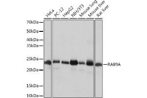 Western blot analysis of extracts of various cell lines, using RA Rabbit mAb (ABIN7269817) at 1:1000 dilution. (RAB9A 抗体)