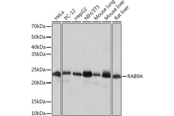 RAB9A Antikörper