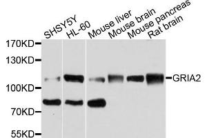Western blot analysis of extracts of various cells, using MET antibody. (c-MET 抗体)