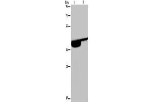 Western Blotting (WB) image for anti-Purinergic Receptor P2x, Ligand-Gated Ion Channel, 3 (P2RX3) antibody (ABIN2435126)