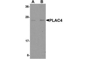 Western blot analysis of PLAC4 in human placenta tissue lysate with PLAC4 antibody at (A) 1 and (B) 2 μg/ml. (PLAC4 抗体  (Center))