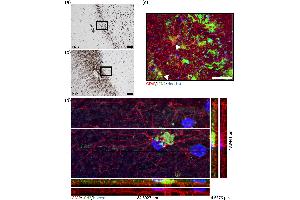 Lipocalin 2 (LCN2) expression in the active rim of multiple sclerosis (MS) lesions. (Lipocalin 2 抗体  (AA 21-200))