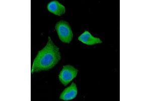 IF analysis of DAB2 using anti-DAB2 antibody (ABIN7602613).