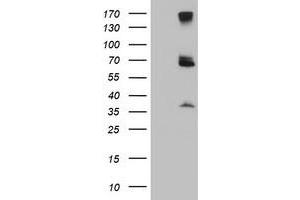 Western Blotting (WB) image for anti-Proteasome (Prosome, Macropain) 26S Subunit, Non-ATPase, 3 (PSMD3) antibody (ABIN1499980) (PSMD3 抗体)