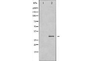 Western blot analysis of RFA2 expression in K562 whole cell lysates,The lane on the left is treated with the antigen-specific peptide. (RPA2 抗体  (N-Term))