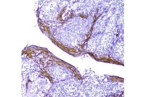 IHC analysis of Periplakin using anti-Periplakin antibody (ABIN5518787).