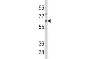 Western Blotting (WB) image for anti-Cytochrome P450, Family 1, Subfamily B, Polypeptide 1 (CYP1B1) (AA 143-176) antibody (ABIN3030676)