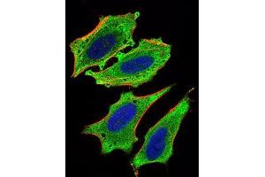 Immunofluorescence analysis of Hela cells using MLXIPL mouse mAb (green). (MLXIPL 抗体  (AA 18-143))