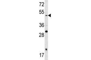 Western blot analysis of SOX4 antibody and A2058 lysate. (SOX4 抗体  (AA 86-114))