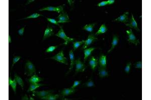 Immunofluorescence (IF) image for anti-Lectin, Galactoside-Binding, Soluble, 9 (LGALS9) (AA 1-323) antibody (ABIN7153467)