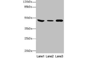 Western Blot All lanes: B4GALT5 antibody at 8 μg/mL Lane 1: Mouse heart tissue Lane 2: Mouse liver tissue Lane 3: Mouse brain tissue Secondary Goat polyclonal to rabbit IgG at 1/10000 dilution Predicted band size: 46 kDa Observed band size: 46 kDa (B4GALT5 抗体  (AA 101-388))